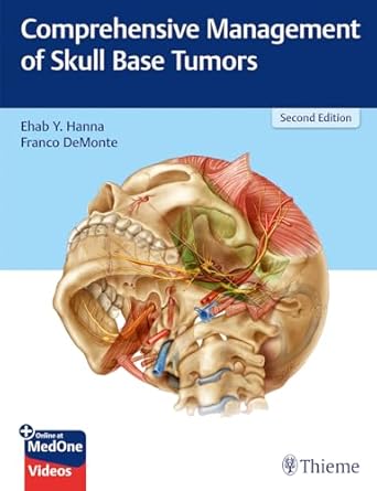 Comprehensive Management of Skull Base Tumors 2nd Ed.