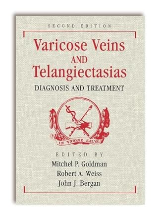 Varicose Veins and Telangiectasias: Diagnosis and Treatment 2nd Edition