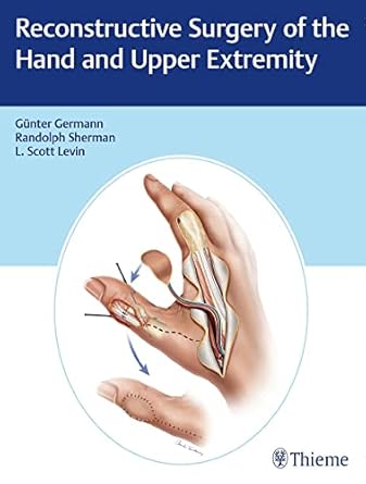 Reconstructive Surgery of the Hand and Upper Extremity 1st Edition