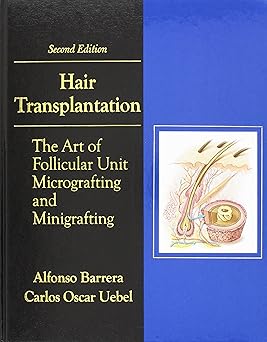 Hair Transplantation 2nd Edition