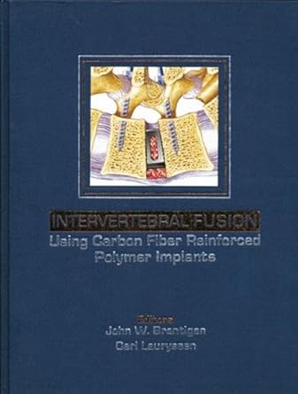 Intervertebral Fusion Using Carbon Fiber Reinforced Polymer Implants 1st Edition