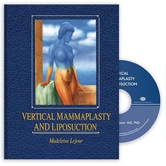 Vertical Mammaplasty and Liposuction 1st Edition