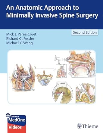 An Anatomic Approach to Minimally Invasive Spine Surgery
