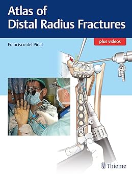 Atlas of Distal Radius Fractures 1st edition