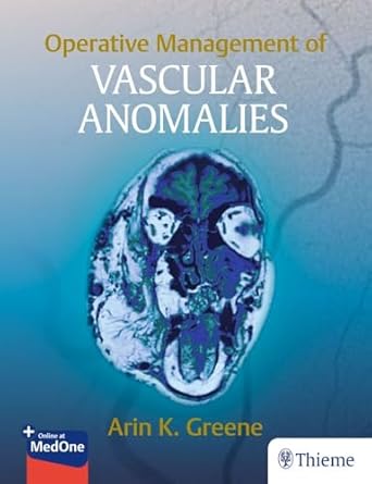 Operative Management of Vascular Anomalies