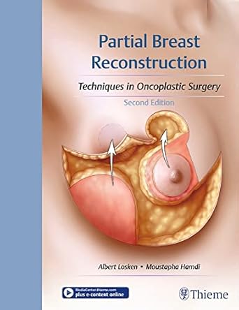 Partial Breast Reconstruction 2nd Edition