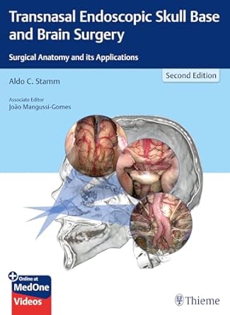 Transnasal Endoscopic Skull Base and Brain Surgery 2nd Ed.