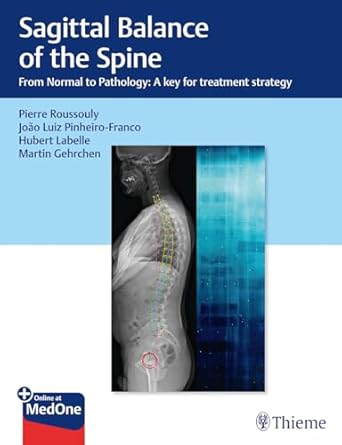 Sagittal Balance of The Spine 1st Ed.