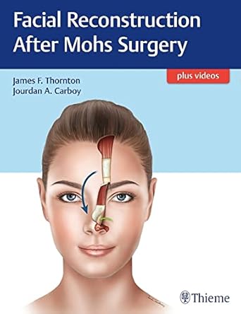 Facial Reconstruction After Mohs Surgery 1st Ed.