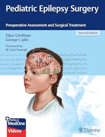 Pediatric Epilepsy Surgery 2nd ed.