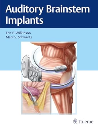 Auditory Brainstem Implants 1st Ed.