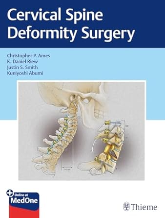 Cervical Spine Deformity Surgery 1st Ed.