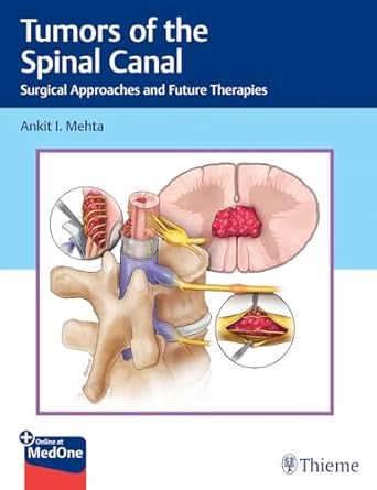 Tumors of the Spinal Canal 1st Ed.