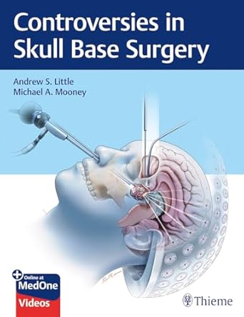 Controversies in Skull Base Surgery 1st Ed.