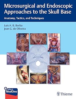 Microsurgical and Endoscopic Approaches to the Skull Base 1st Ed.