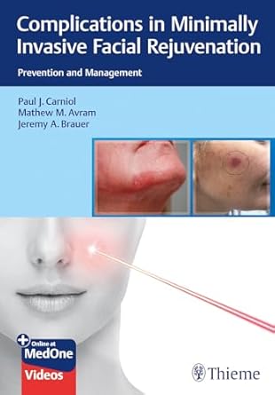 Complications in Minimally Invasive Facial Rejuvenation