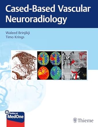 Imaging in Neurovascular Disease 1st Ed.