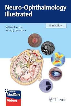 Neuro-Ophthalmology Illustrated