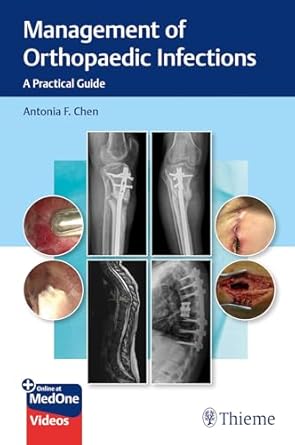 Management of Orthopaedic Infections : A Practical Guide 1st Ed.