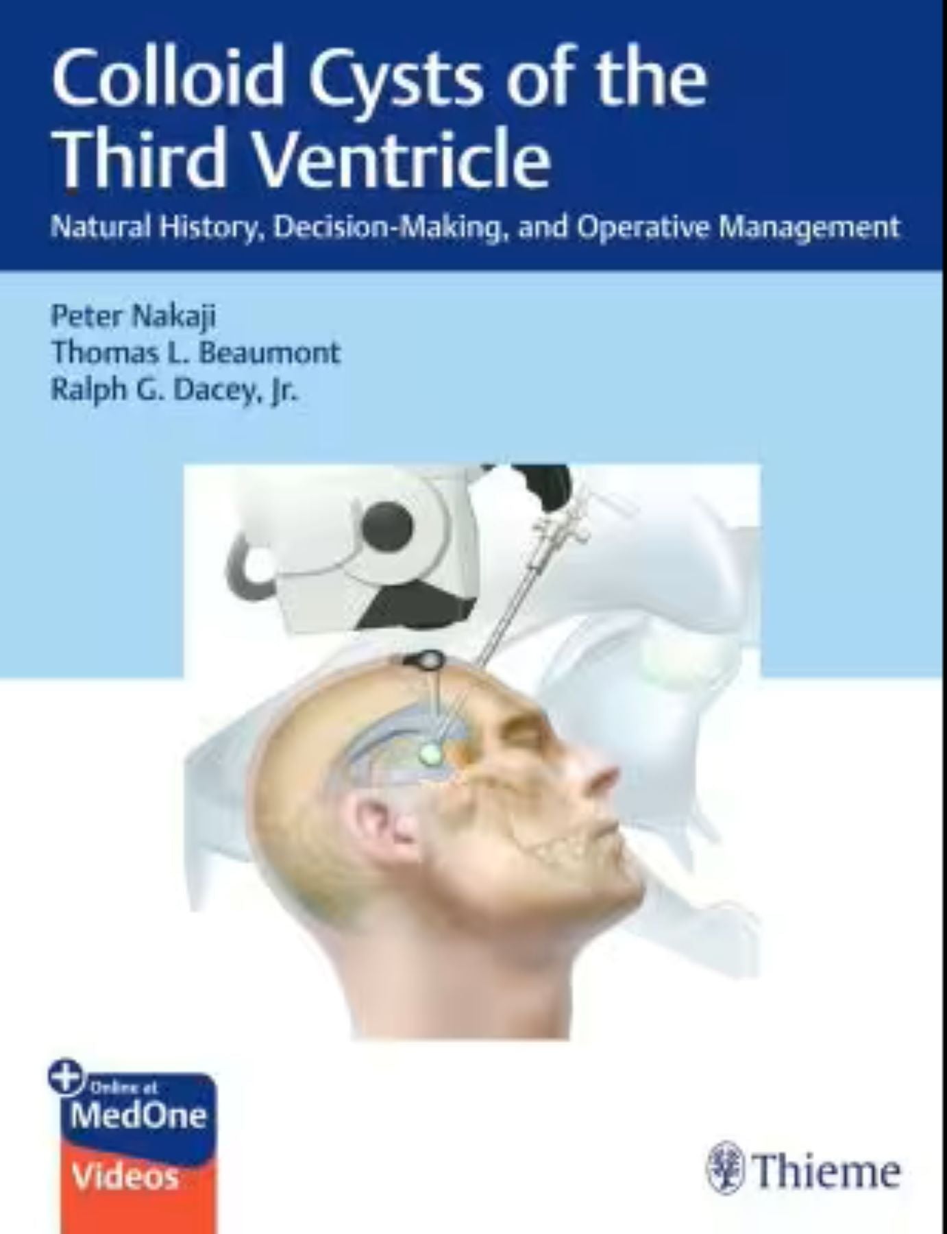 Colloid Cysts of the Third Ventricle