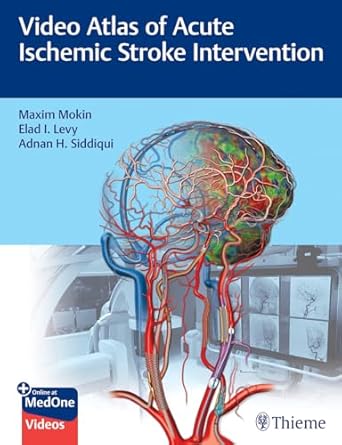 Video Atlas of Acute Ischemic Stroke Intervention 1st Ed.