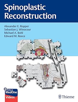 Spinoplastic Reconstruction 1st Edition