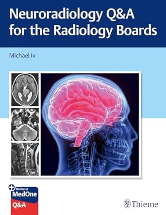 Neuroradiology Q&A for the Radiology Boards 1st Ed.