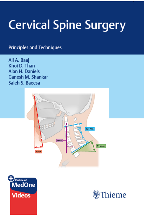 Cervical Spine Surgery