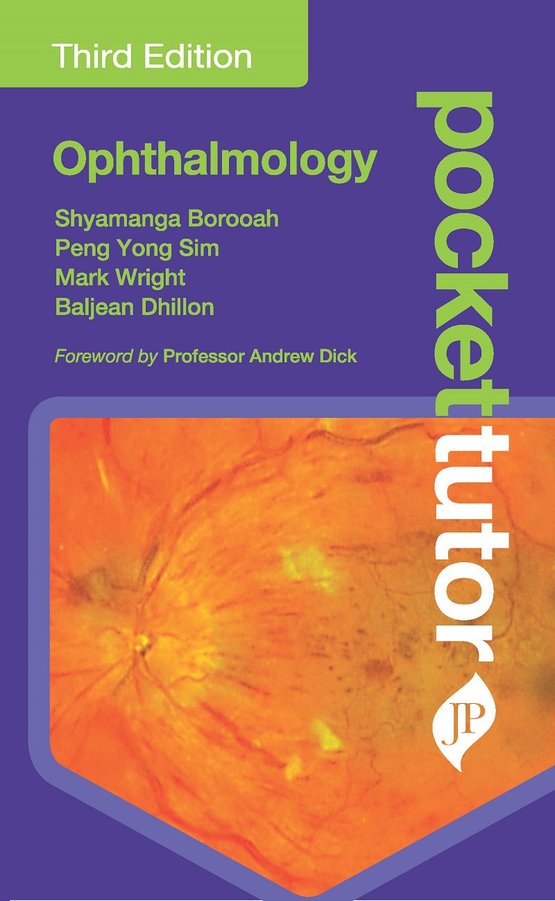 POCKET TUTOR OPHTHALMOLOGY