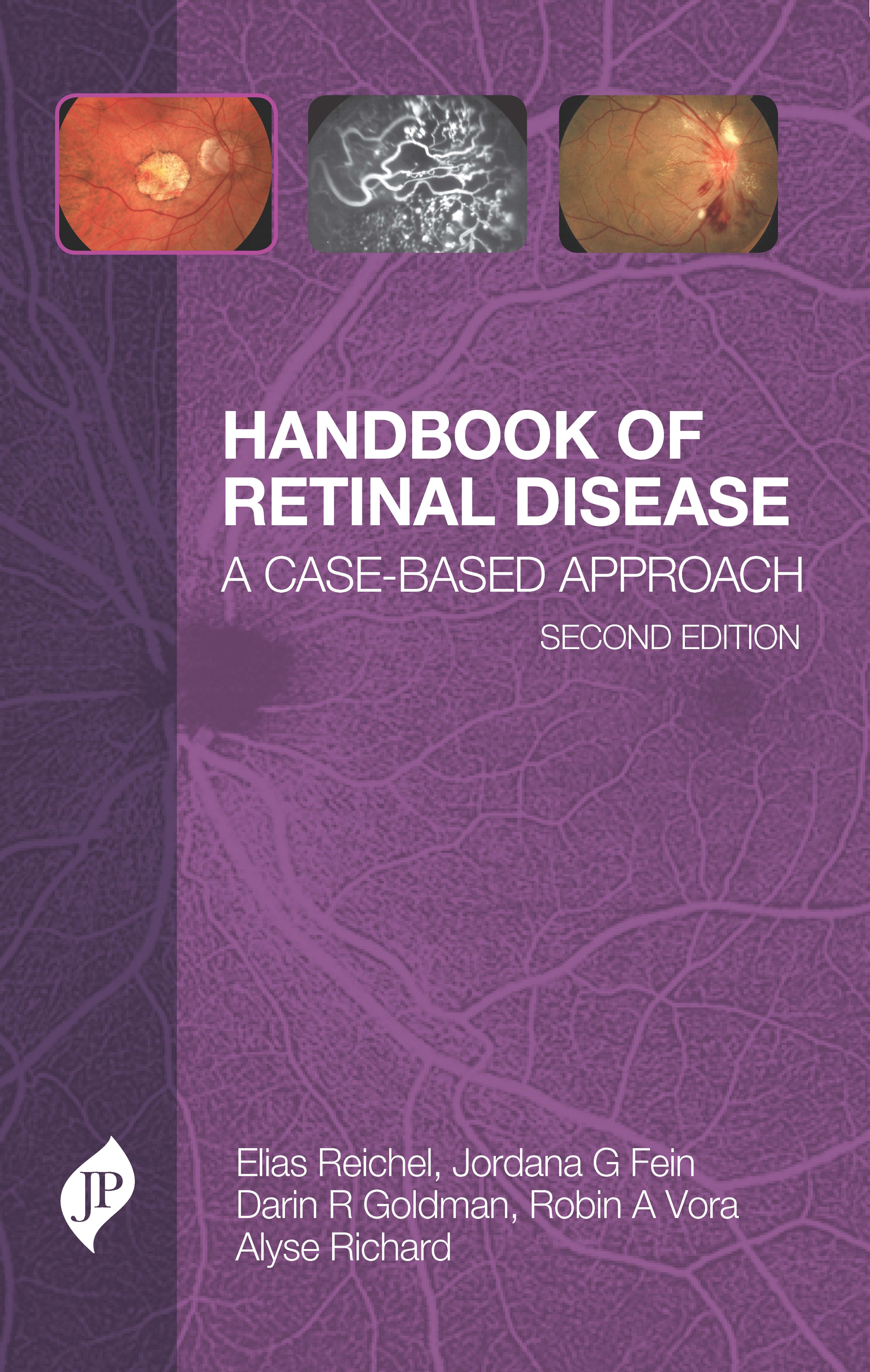 HANDBOOK OF RETINAL DISEASE: A CASE- BASED APPROACH