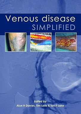 VENOUS DISEASE SIMPLIFIED