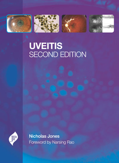 UVEITIS WITH CD-ROM