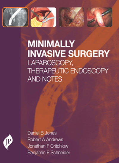 MINIMALLY INVASIVE SURGERY LAPAROSCOPY,THERAPEUTIC ENDOSCOPY AND NOTES