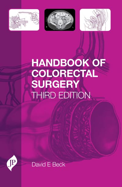 HANDBOOK OF COLORECTAL SURGERY