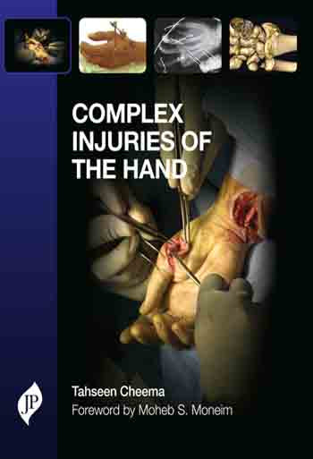 COMPLEX INJURIES OF THE HAND