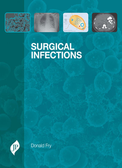 SURGICAL INFECTIONS