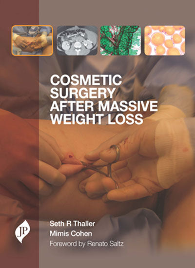 COSMETIC SURGERY AFTER MASSIVE WEIGHT LOSS