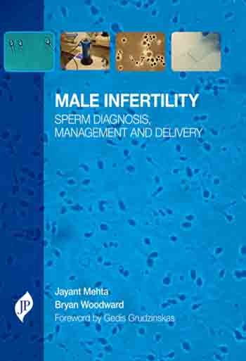 MALE INFERTILITY SPERM DIAGNOSIS MANAGEMENT AND DELIVERY