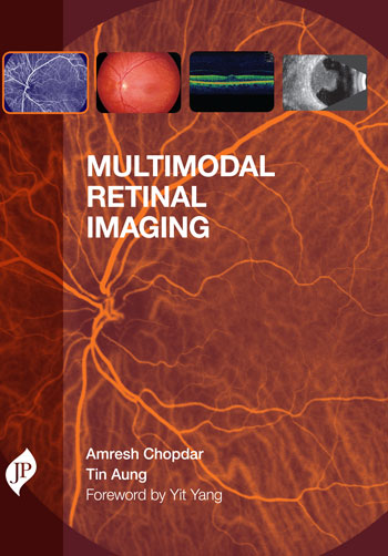 MULTIMODAL RETINAL IMAGING