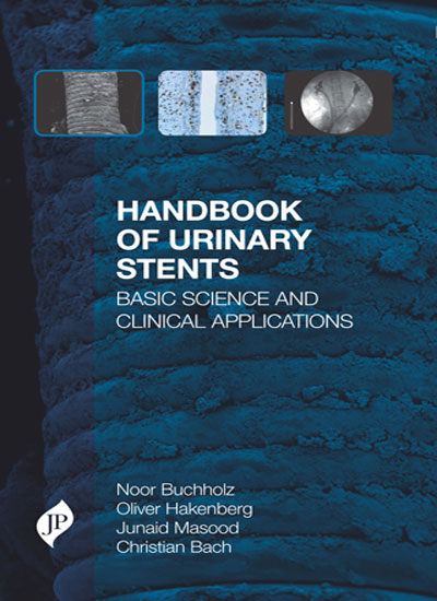 HANDBOOK OF URINARY STENTS BASIC SCIENCE AND CLINICAL APPLICATIONS