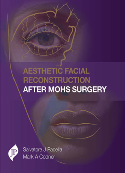 AESTHETIC FACIAL RECONSTRUCTION AFTER MOHS SURGERY