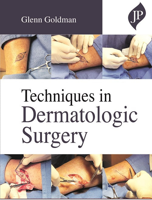 TECHNIQUES IN DERMATOLOGIC SURGERY