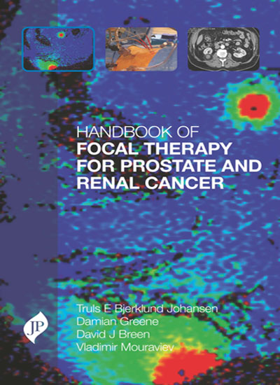 HANDBOOK OF FOCAL THERAPY FOR PROSTATE AND RENAL CANCER