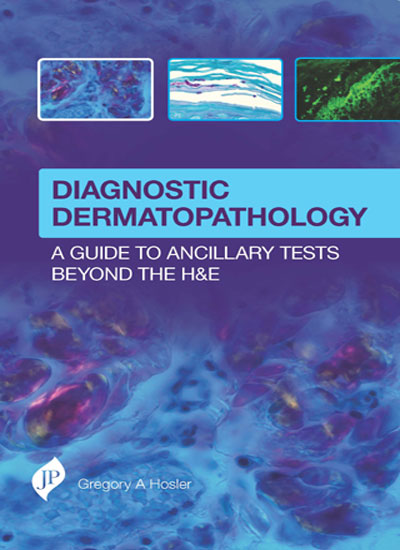 DIAGNOSTIC DERMATOPATHOLOGY:A GUIDE TO ANCILLARY TESTS BEYOND THE H&E