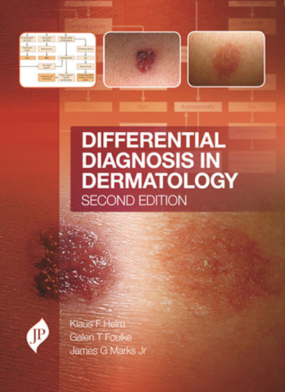 DIFFERENTIAL DIAGNOSIS IN DERMATOLOGY