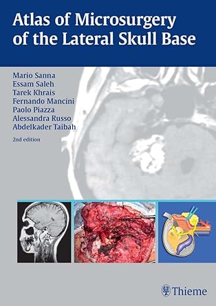 Atlas of Microsurgery of the Lateral Skull Base