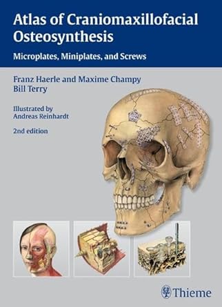 Atlas of Craniomaxillofacial Osteosynthesis 2nd ED