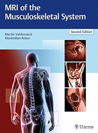 MRI of the Musculoskeletal System 2nd Edition