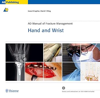 AO Manual of Fracture Management Hand and Wrist Bo