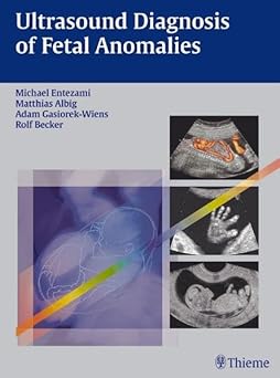 Ultrasound Diagnosis of Fetal Anomalies